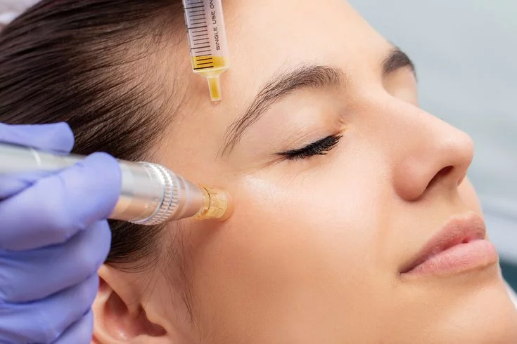 Skin Needling